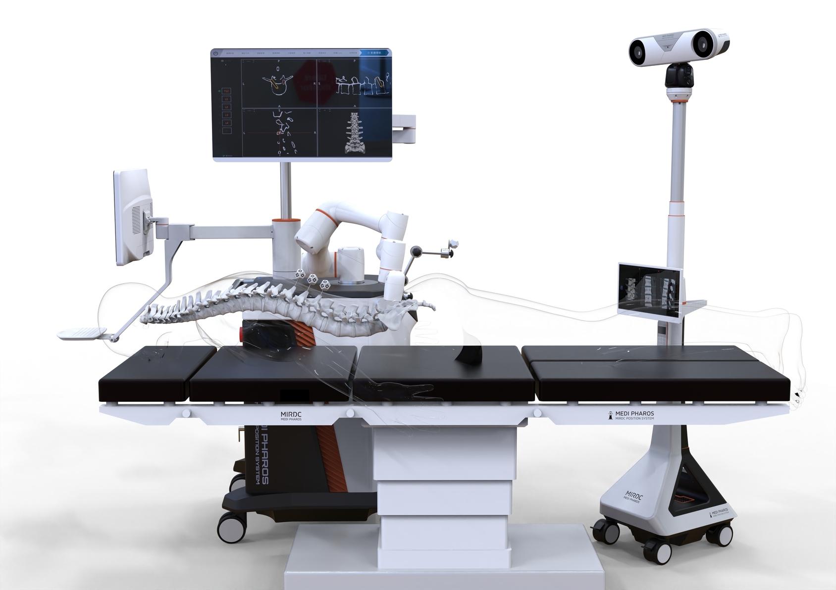 Smart spine surgery assistance system-1