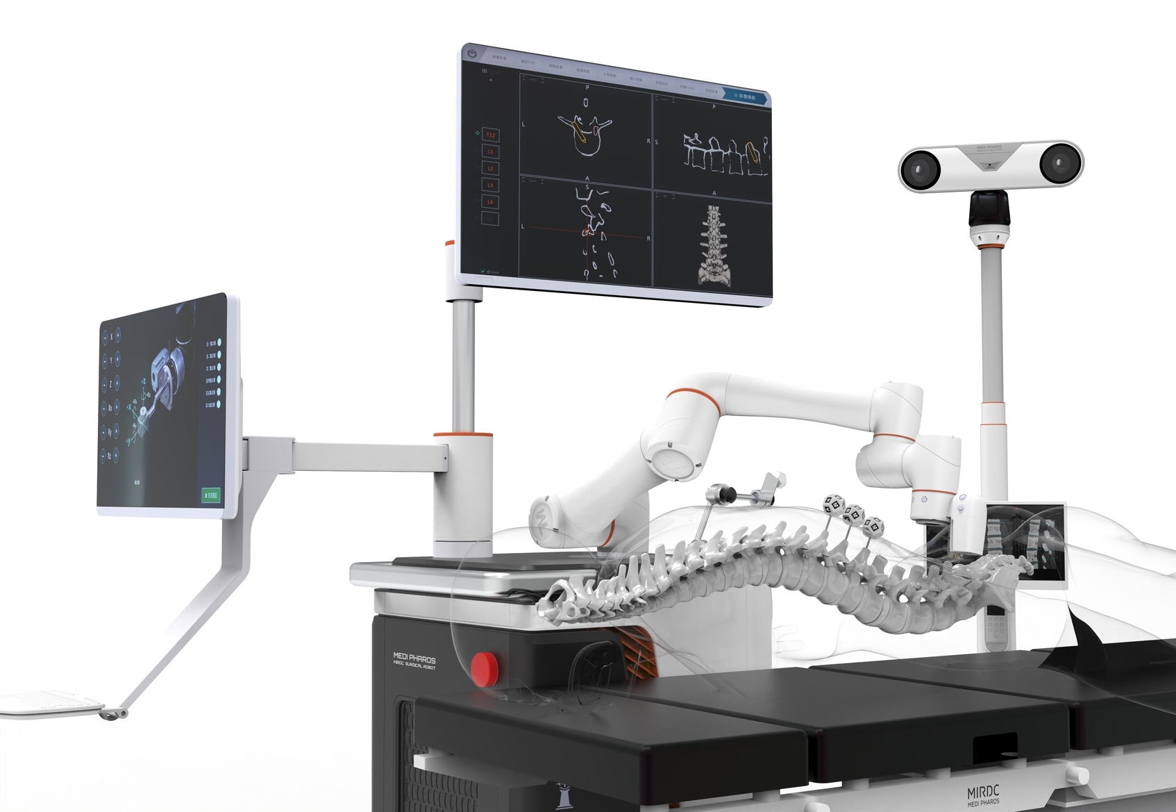 Smart spine surgery assistance system-3